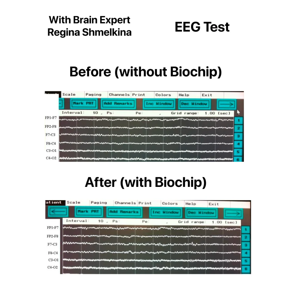 FRDY QuantumShield EMF Chip