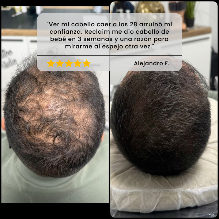 Sérum Roll-On Avanzado para el Crecimiento del Cabello - 2 Suministro