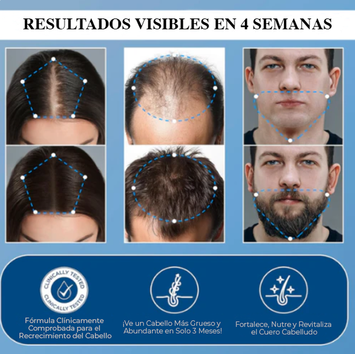 Sérum Roll-On Avanzado para el Crecimiento del Cabello